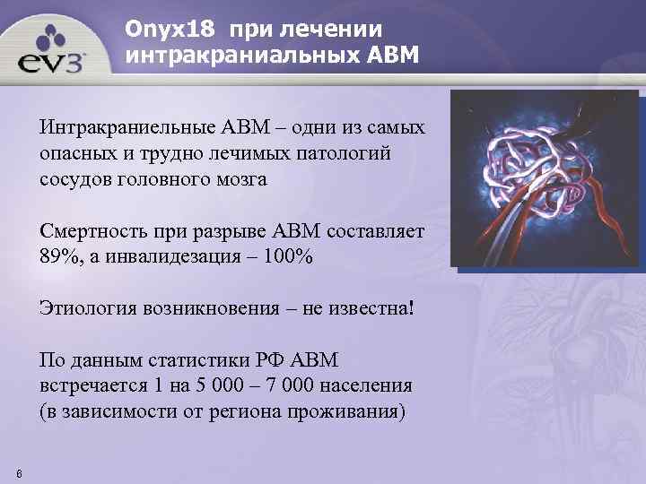    Onyx 18 при лечении   интракраниальных АВМ  Интракраниельные АВМ