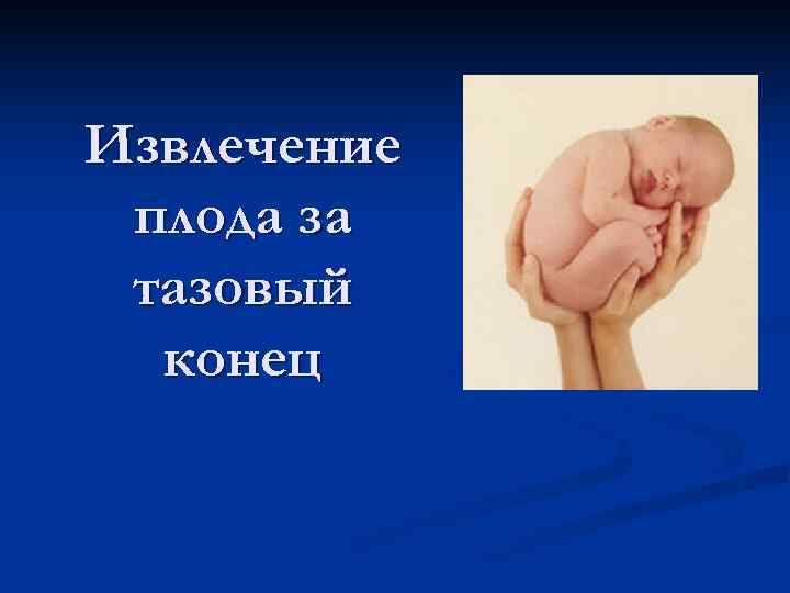 Извлечение плода за тазовый  конец 