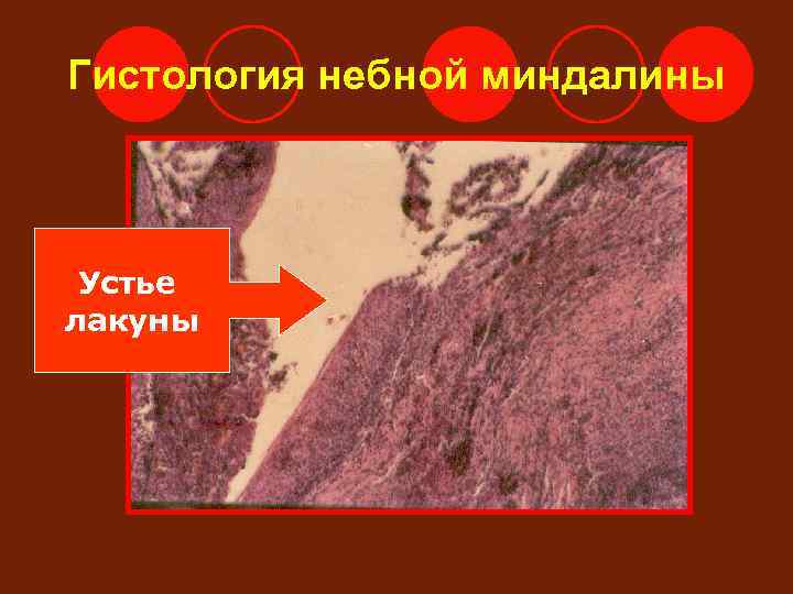 Гистология небной миндалины Устье лакуны 