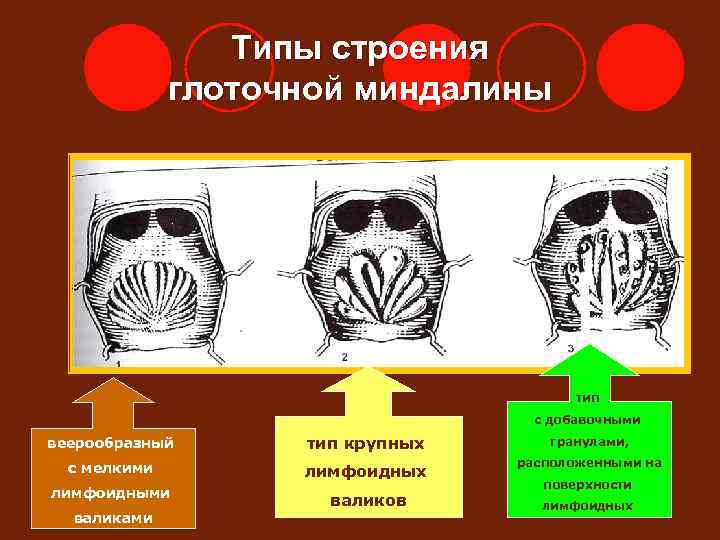    Типы строения    глоточной миндалины    