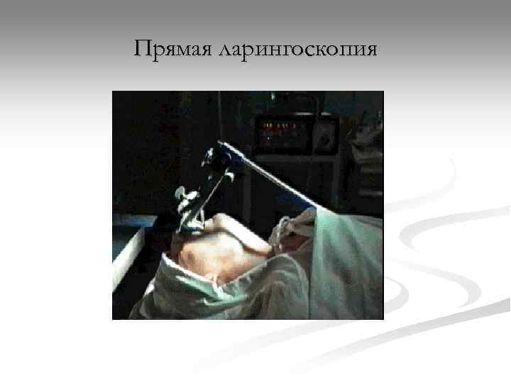 Прямая ларингоскопия 