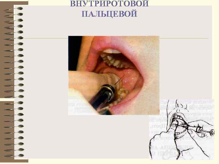 ВНУТРИРОТОВОЙ  ПАЛЬЦЕВОЙ 