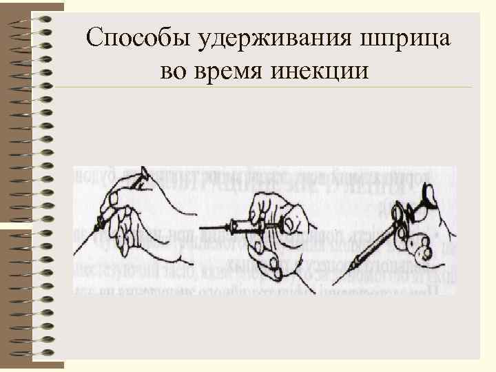 Способы удерживания шприца во время инекции 