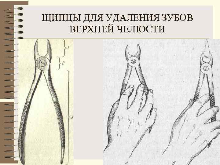 ЩИПЦЫ ДЛЯ УДАЛЕНИЯ ЗУБОВ ВЕРХНЕЙ ЧЕЛЮСТИ 