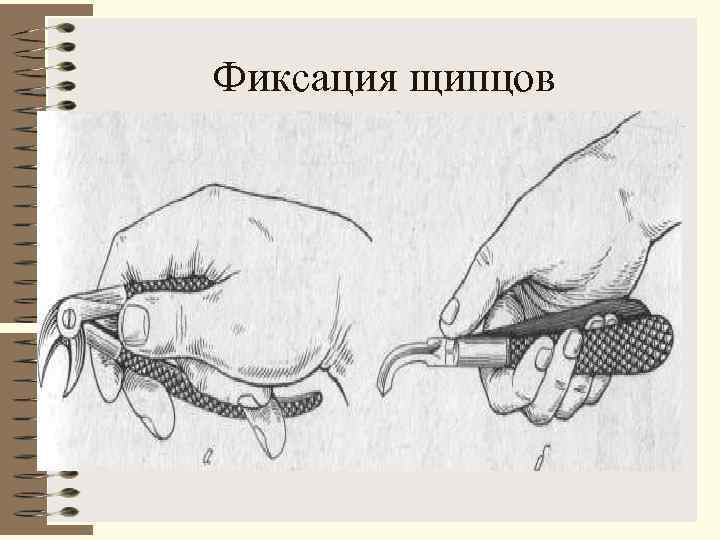 Фиксация щипцов 