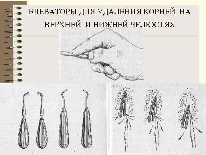 ЕЛЕВАТОРЫ ДЛЯ УДАЛЕНИЯ КОРНЕЙ НА  ВЕРХНЕЙ И НИЖНЕЙ ЧЕЛЮСТЯХ 