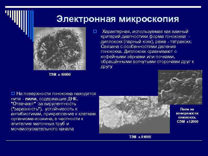     Электронная микроскопия      o Характерная, используемая