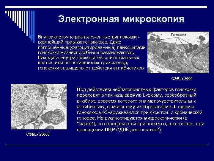     Электронная микроскопия o  Внутриклеточно расположенные диплококки -  важнейший