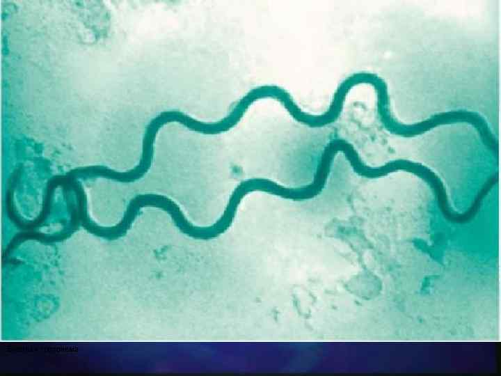  Бледная трепонема 