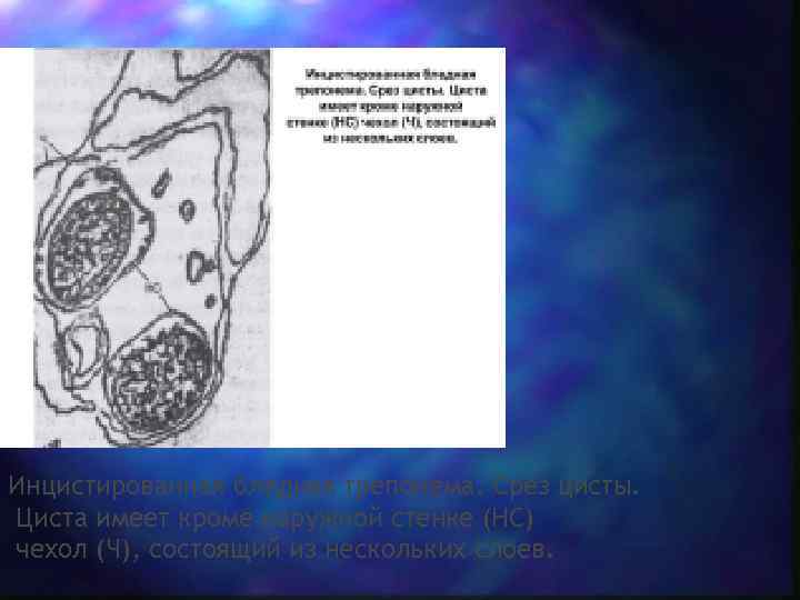 Инцистированная бледная трепонема. Срез цисты. Циста имеет кроме наружной стенке (НС) чехол (Ч), состоящий