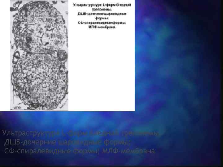 Ультраструктура L-форм бледной трепонемы.  ДШБ-дочерние шаровидные формы;  СФ-спиралевидные формы; МЛФ-мембрана. 