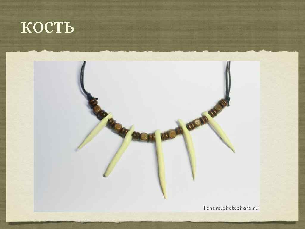 кость 