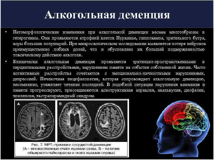     Алкогольная деменция •  Патоморфологические изменения при алкогольной деменции весьма