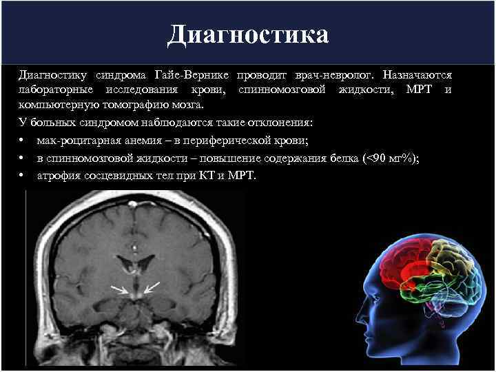      Диагностика Диагностику синдрома Гайе-Вернике проводит врач-невролог.  Назначаются лабораторные