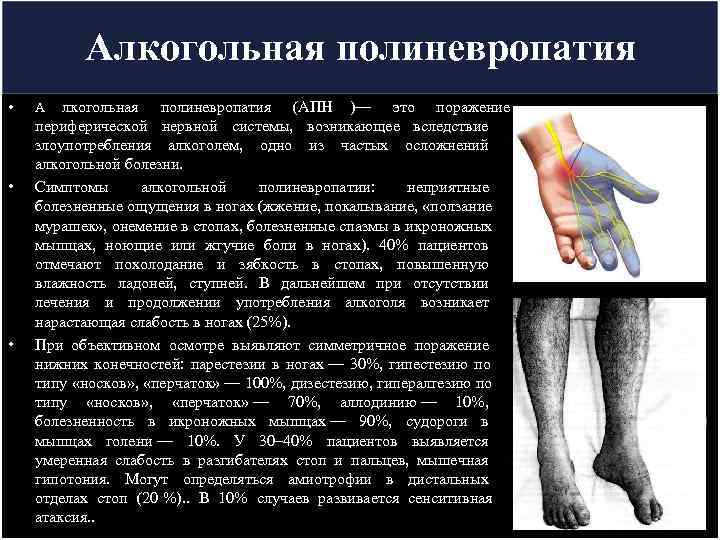   Алкогольная полиневропатия •  А  лкогольная полиневропатия (АПН )— это поражение