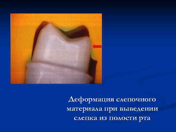 Деформация слепочного материала при выведении  слепка из полости рта 