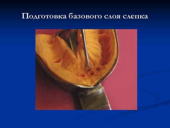 Подготовка базового слоя слепка 