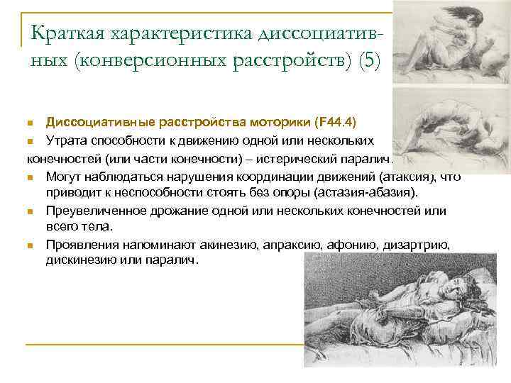 Краткая характеристика диссоциатив- ных (конверсионных расстройств) (5) n Диссоциативные расстройства моторики (F 44. 4)