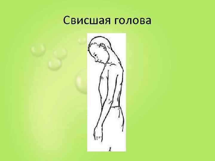 Свисшая голова 