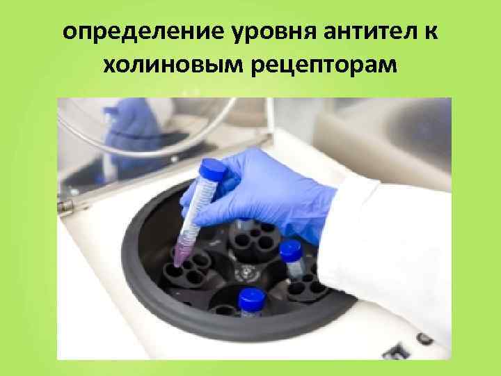 определение уровня антител к  холиновым рецепторам 
