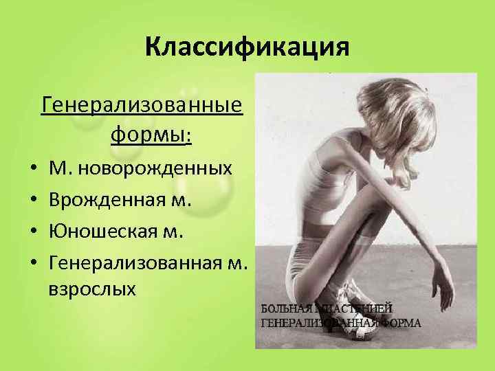    Классификация Генерализованные  формы:  •  М. новорожденных • 