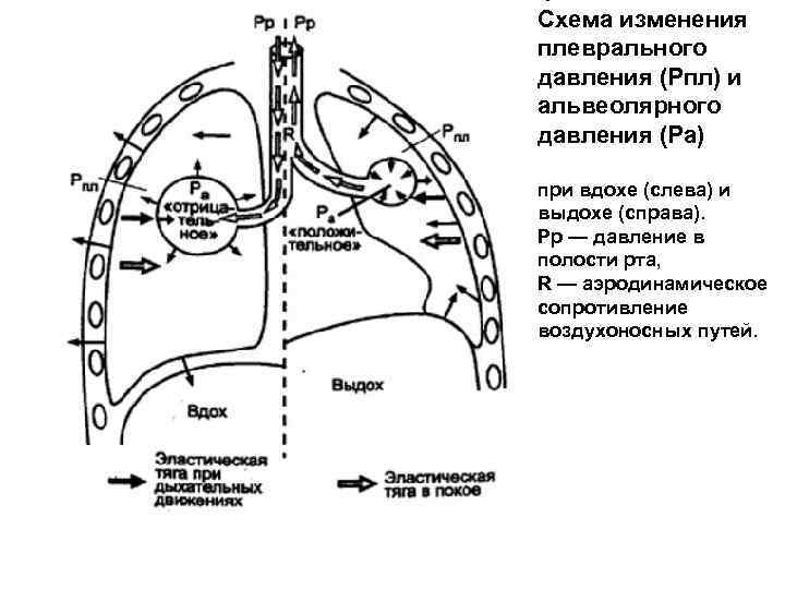 Схема изменения плеврального давления (Рпл) и альвеолярного давления (Ра)  при вдохе (слева) и