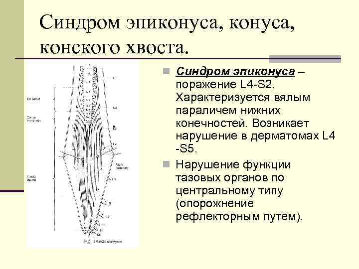 Клиническая картина компрессии корешков конского хвоста отличается от компрессии конуса и эпиконуса