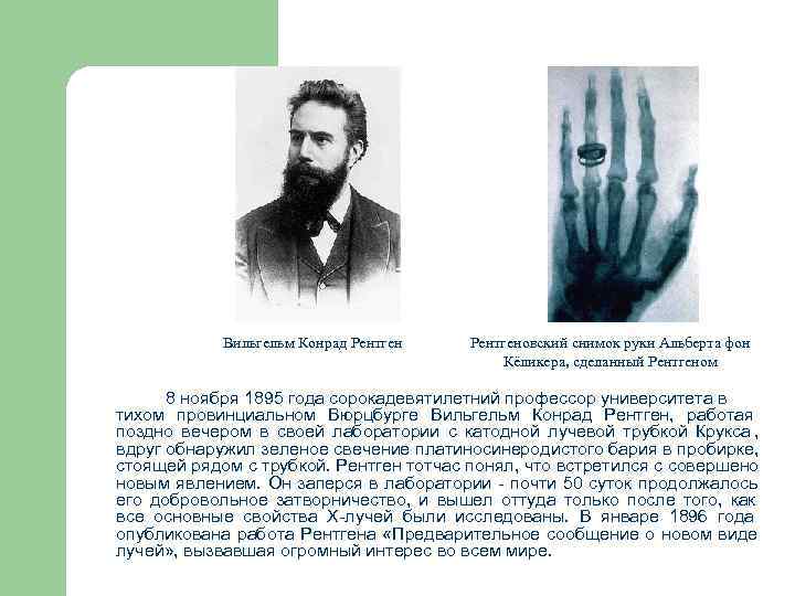   Вильгельм Конрад Рентгеновский снимок руки Альберта фон     Кёликера,