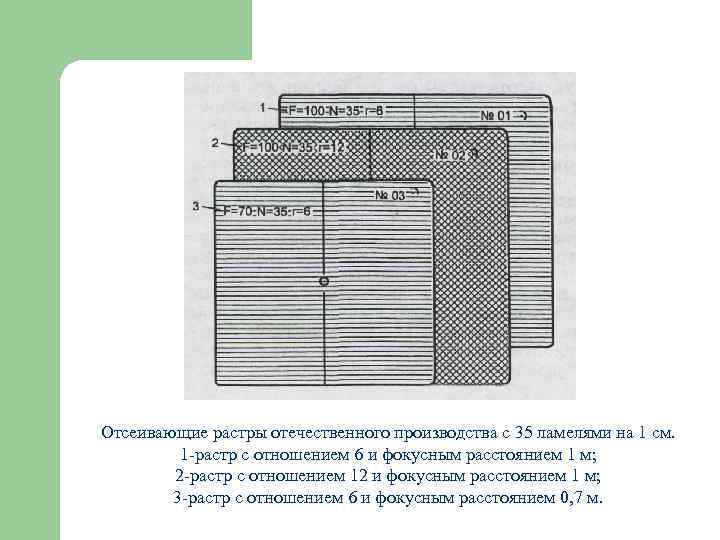 Выявление изображения растра решетки на рентгенограмме свидетельствует о