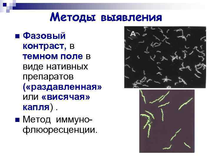 Методы выявления n Фазовый контраст, в темном поле в виде Методы выявления n Фазовый контраст, в темном поле в виде