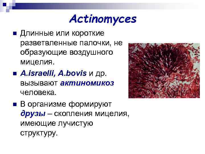 Actinomyces n Длинные или короткие разветвленные палочки, не образующие Actinomyces n Длинные или короткие разветвленные палочки, не образующие