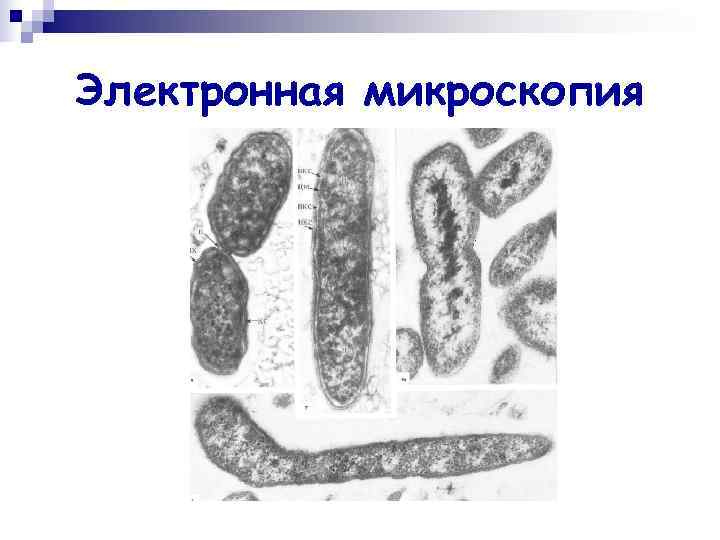 Электронная микроскопия Электронная микроскопия