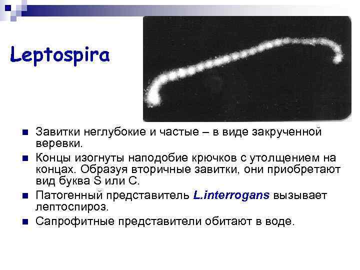 Leptospira n Завитки неглубокие и частые – в виде закрученной веревки. Leptospira n Завитки неглубокие и частые – в виде закрученной веревки.