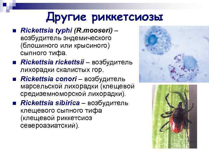   Другие риккетсиозы n  Rickettsia typhi (R. mooseri) – возбудитель эндемического (блошиного