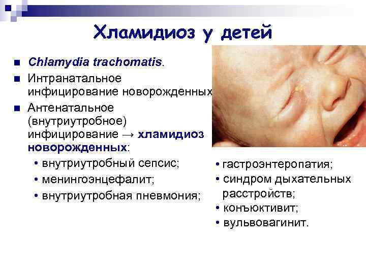    Хламидиоз у детей n  Chlamydia trachomatis. n  Интранатальное инфицирование
