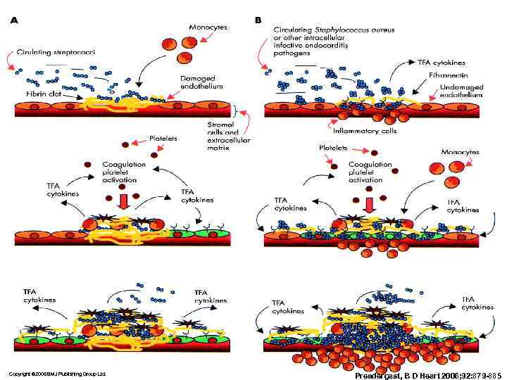 Copyright © 2006 BMJ Publishing Group Ltd.     Prendergast, B D