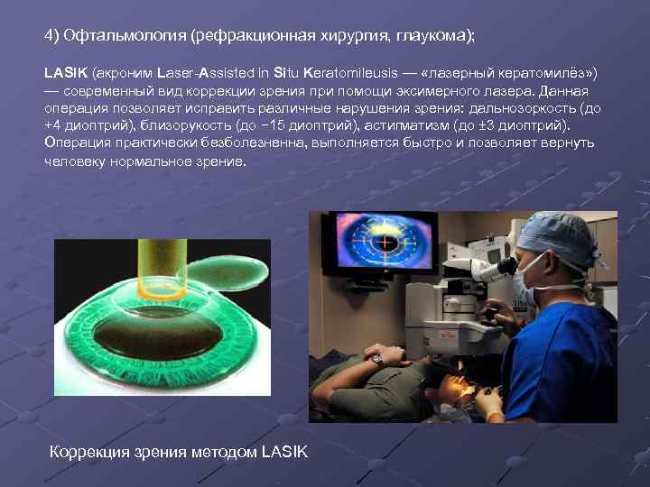 4) Офтальмология (рефракционная хирургия, глаукома);  LASIK (акроним Laser-Assisted in Situ Keratomileusis — «лазерный