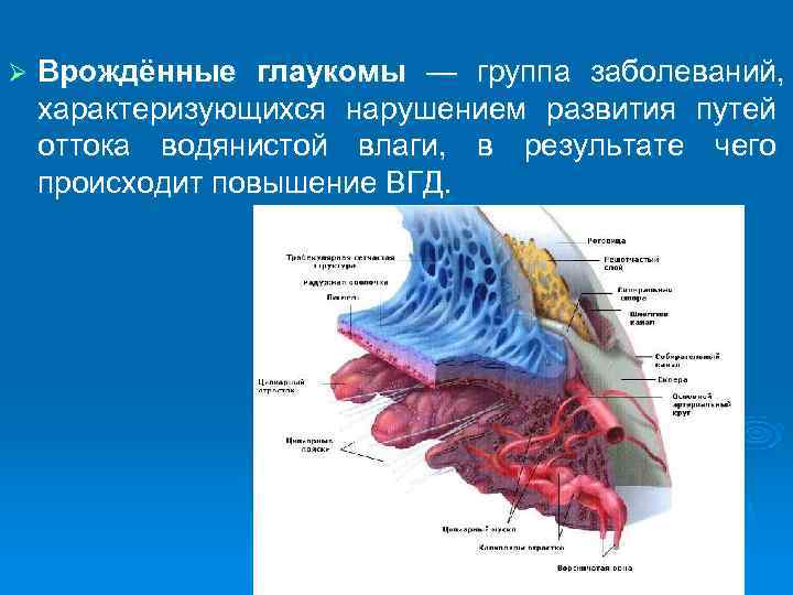 Ø  Врождённые глаукомы — группа заболеваний,  характеризующихся нарушением развития путей оттока водянистой