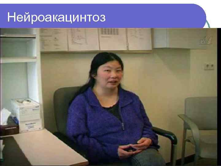 Нейроакацинтоз 