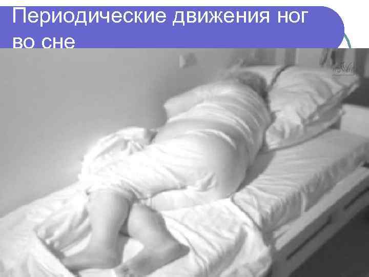 Периодические движения ног во сне 