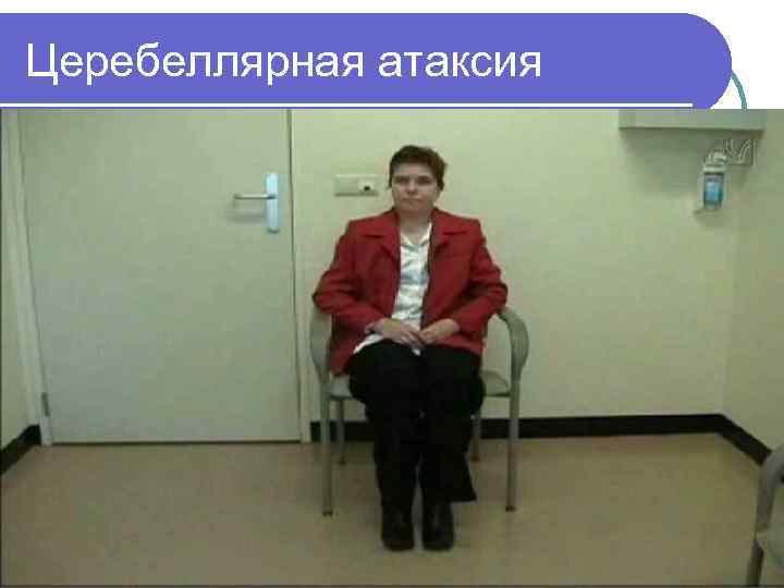 Церебеллярная атаксия 