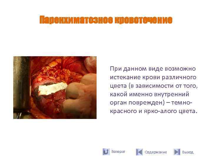 Паренхиматозное кровотечение    При данном виде возможно    истекание крови