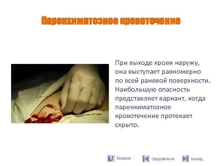 Паренхиматозное кровотечение   При выходе крови наружу,    она выступает равномерно