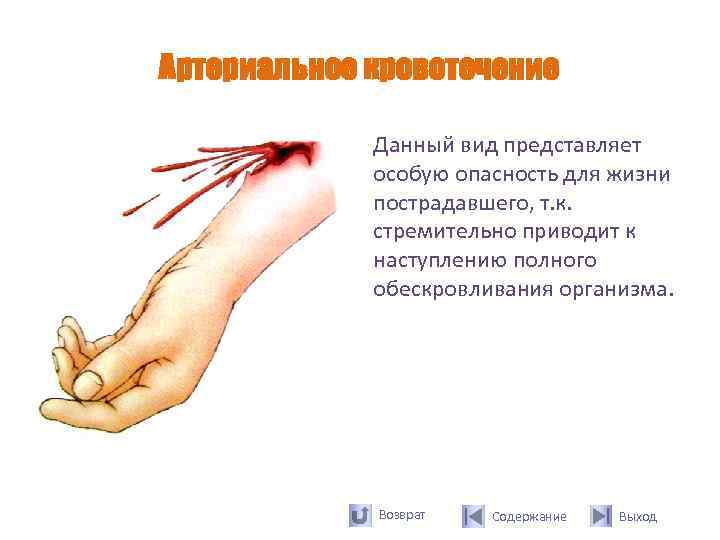 Артериальное кровотечение    Данный вид представляет   особую опасность для жизни