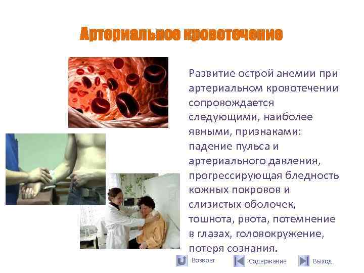 Артериальное кровотечение    Развитие острой анемии при   артериальном кровотечении 