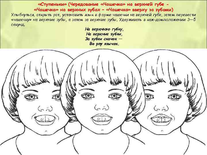 «Ступеньки» (Чередование «Чашечка» на верхней губе - «Чашечка» на верхних зубах «Ступеньки» (Чередование «Чашечка» на верхней губе - «Чашечка» на верхних зубах