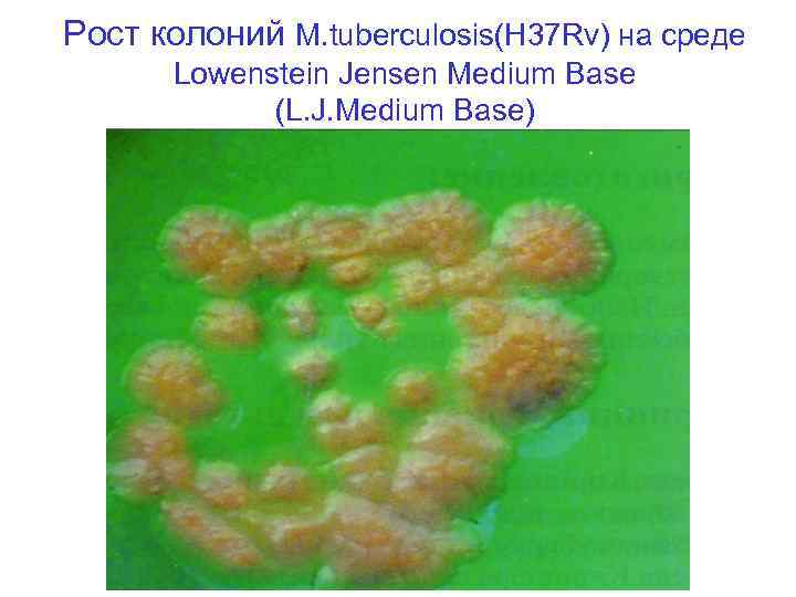 Рост колоний М. tuberculosis(H 37 Rv) на среде  Lowenstein Jensen Medium Base 