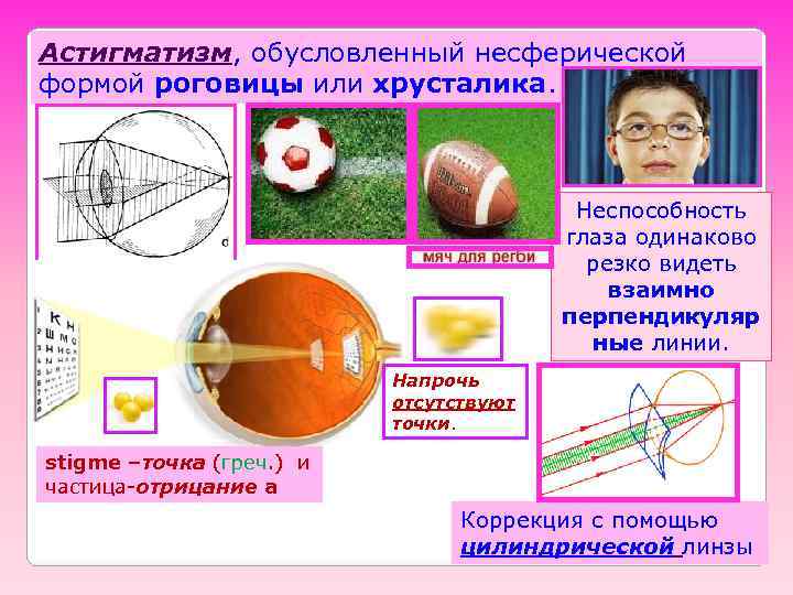 Астигматизм, обусловленный несферической формой роговицы или хрусталика.     Неспособность  