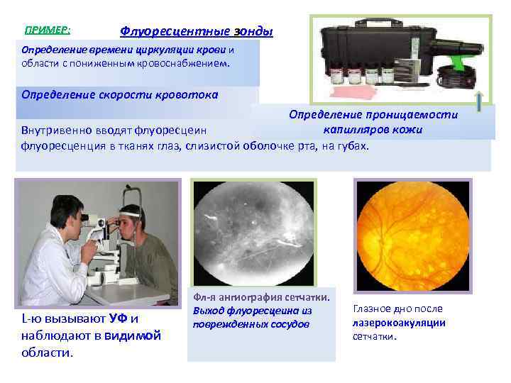 ПРИМЕР: Флуоресцентные зонды Определение времени циркуляции крови и области с пониженным кровоснабжением. ПРИМЕР: Флуоресцентные зонды Определение времени циркуляции крови и области с пониженным кровоснабжением.