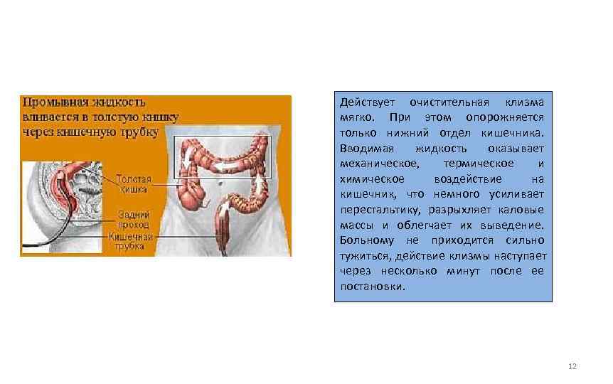 Действует очистительная клизма мягко.  При этом опорожняется только нижний отдел кишечника.  Вводимая